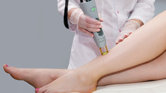 Laser Hair Removal: Unveiling Smooth Perfection